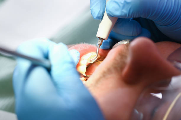 Best Weekend Emergency Dental Services in White Salmon, WA