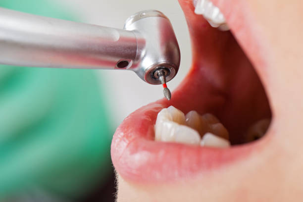 Professional Emergency Dental Service in WA